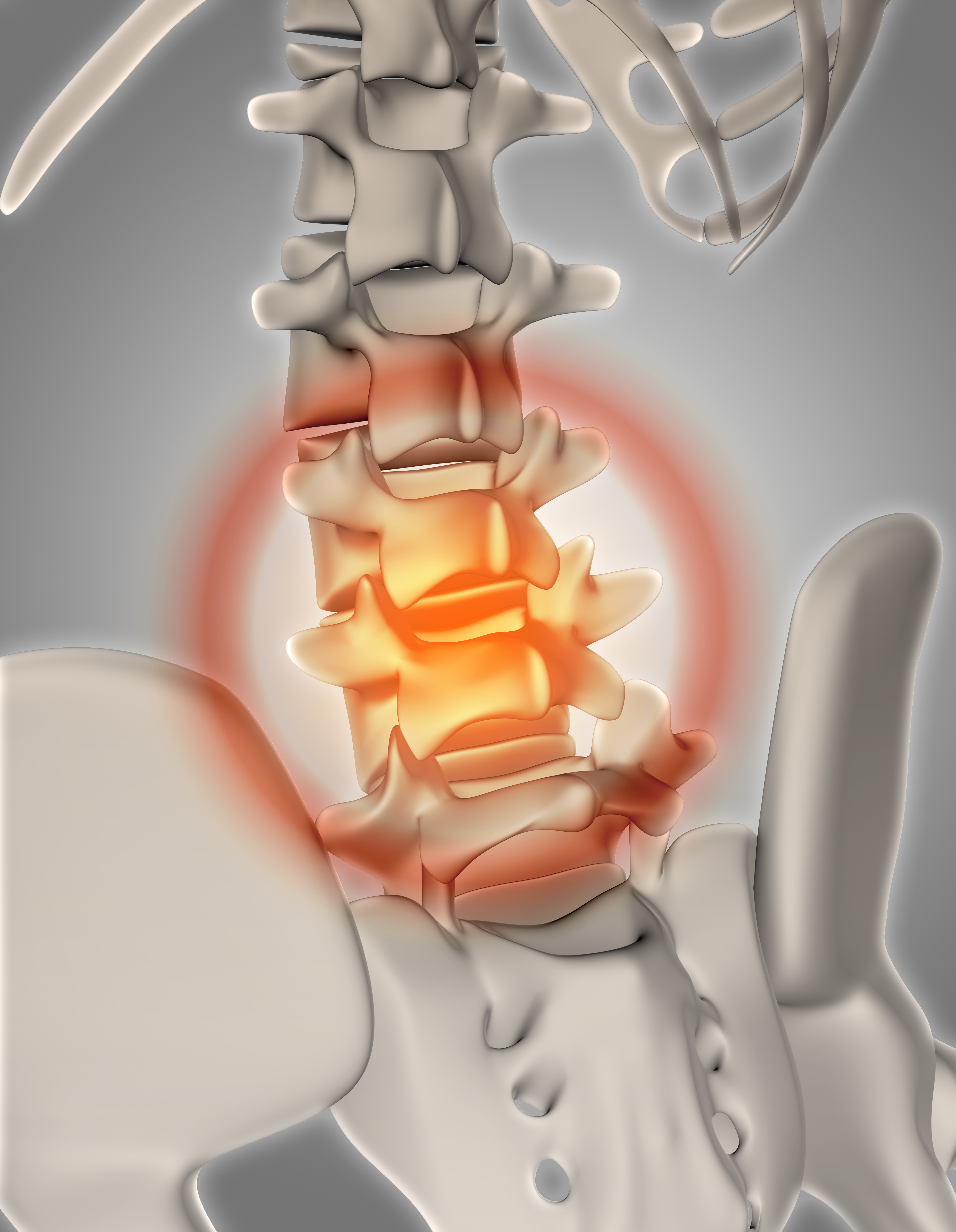 skeleten 3d back pain
